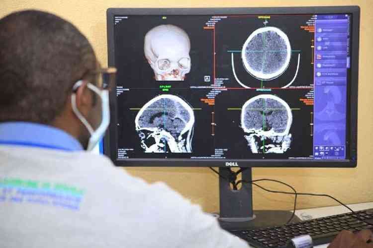 A leitura de exames de imagem por softwares pode ajudar a reduzir o grande volume de trabalho demdicos e levar tecnologia a locais com escassez de radiologistas