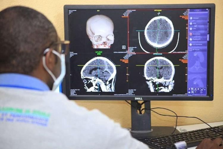 A leitura de exames de imagem por softwares pode ajudar a reduzir o grande volume de trabalho de médicos e levar tecnologia a locais com escassez de radiologistas