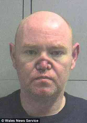 Cartilagem do septo nasal de james Brown foi comprometida pela cocana(foto: Daily Mail/Reproduo)