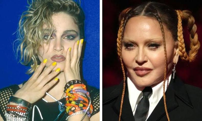 Montagem de duas fotos:  esquerda, Madonna jovem, loura;  direita, uma foto atual em que ela aparece de cabelos com tranas e rosto com plsticas