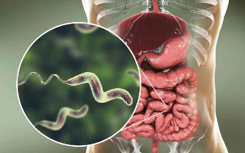 Ilustrao de organismo com diarreia causada por bactria
