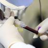 Ministério da Saúde lança campanha de incentivo à doação de sangue