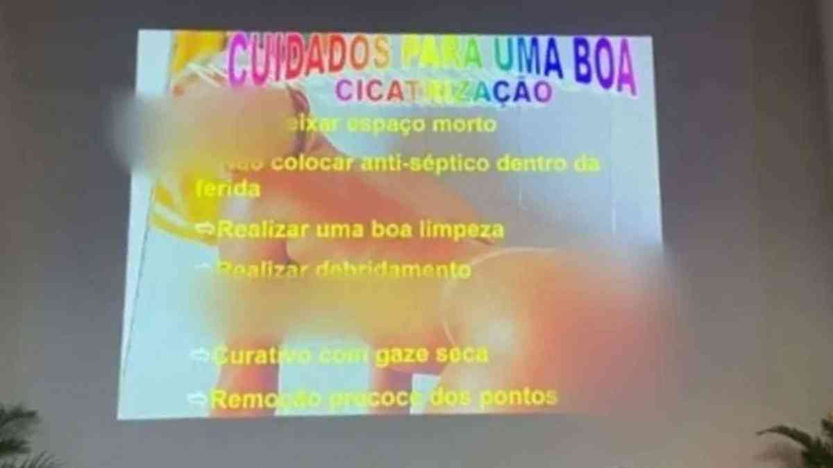 Slide de aula de medicina que mostra mulher nua viraliza na internet -  Nacional - Estado de Minas