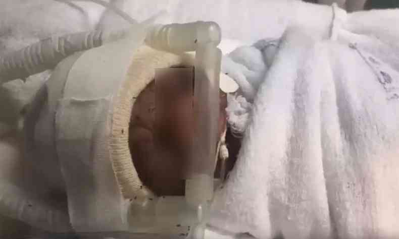 Beb internado na maternidade foi alvo da infestao de formigas no CTI neonatal da maternidade (foto: Reproduo/ Internet/ Youtube )