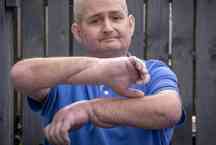 O transplante de mãos que deu 'nova vida' a homem com doença rara