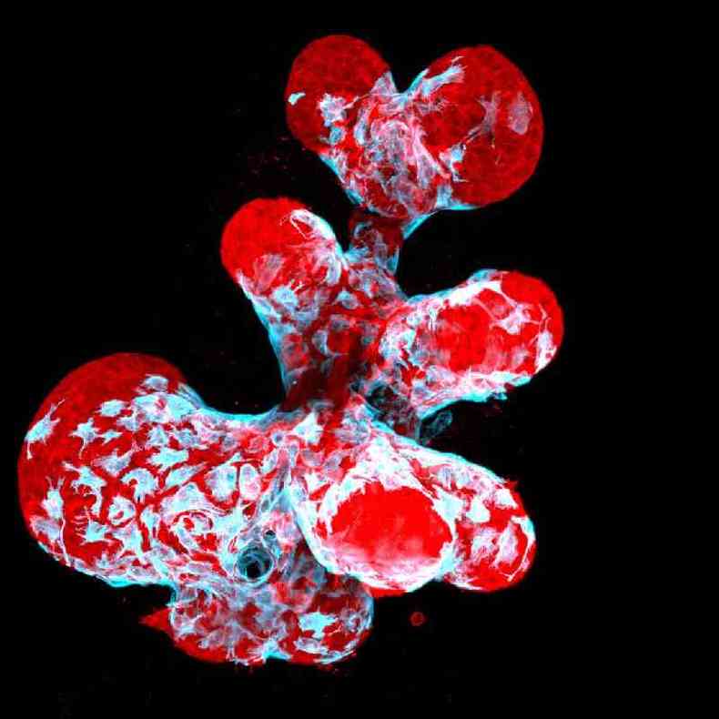 Parece uma criatura do fundo do mar, mas , na verdade, um organoide mamrio, que mostra clulas contrteis mioepiteliais (em azul) e clulas secretoras (em vermelho) %u2014 a imagem foi feita por Jakub Sumbal, da Universidade Masaryk, na Repblica Tcheca