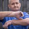 O transplante de mãos que deu 'nova vida' a homem com doença rara