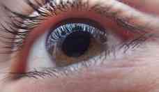 COVID-19 pode agravar doenas oftalmolgicas