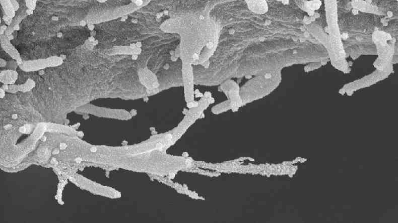 As imagens reveladas pelo estudo mostram clulas humanas infectadas com um detalhamento indito
