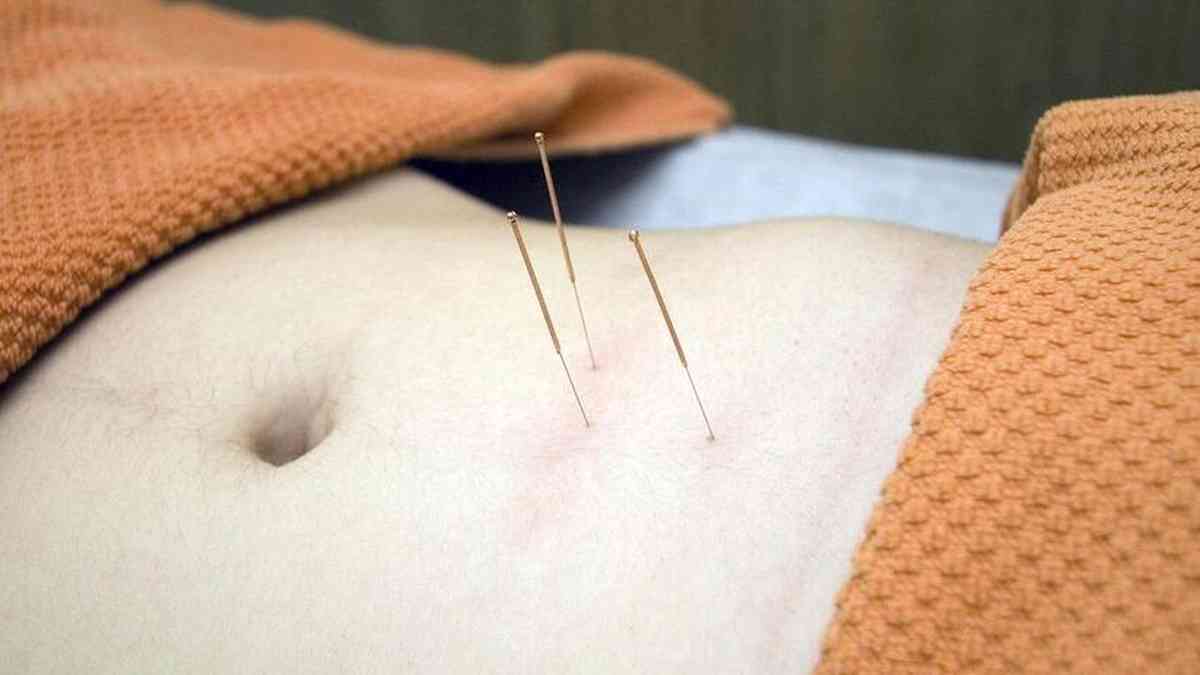 Examination of acupuncture: understanding what is proven and what is not – Said