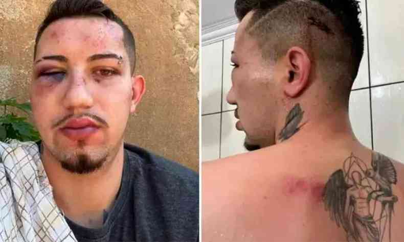 Marcos Mendona Gonalves, de 23 anos, teve ferimentos e hematomas no rosto, cabea e costas 