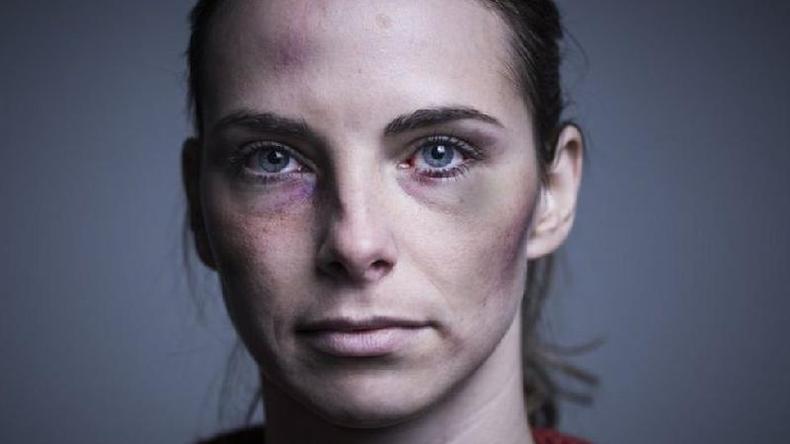 O impacto duradouro do controle coercitivo no  to visvel quanto uma cicatriz ou hematoma