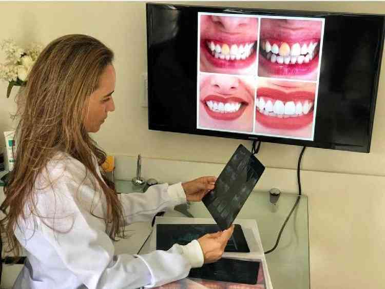 Carine Castro Valle, dentista e proprietria da Castro Valle odontologia, alerta que antes de realizar o procedimento  necessrio avaliar minuciosamente a sade bucal do paciente