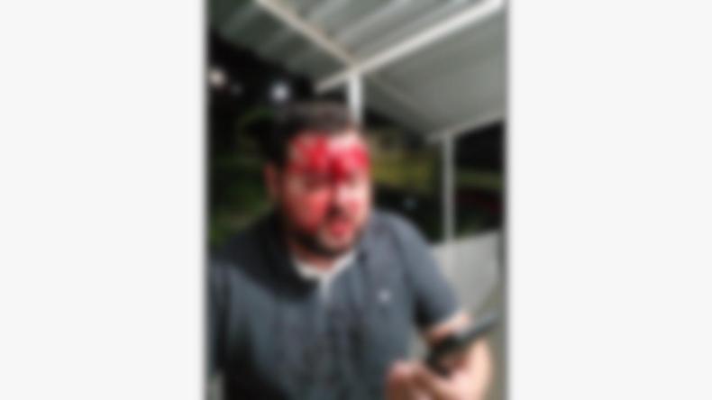 Um dos vereadores foi ferido em confusão na Câmara(foto: Sérgio Pelegrino/DIvulgação) Foto mostra vereador ferido após confusão em Câmara no Sul de Minas
