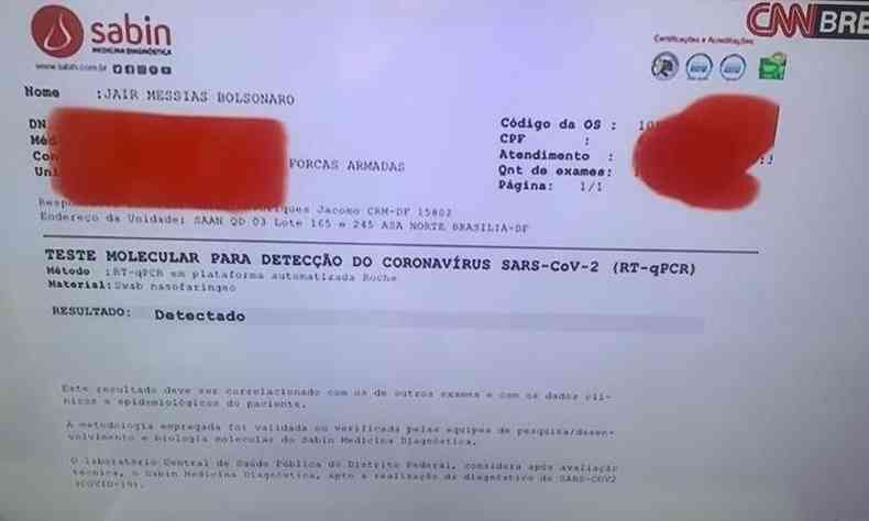O presidente Jair Bolsonaro realizou o teste de RT-qPCR para identificar a presena do coronavrus