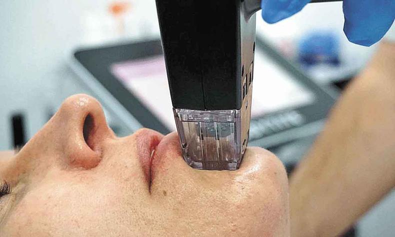 couro cabeludo com psorase