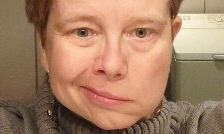 mulher com a boca torta