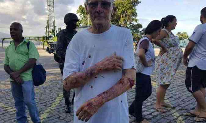 Frei Pedro Engel, de 80 anos, mostra os ferimentos aps ser amarrado e assaltado em Vila Velha, no ES