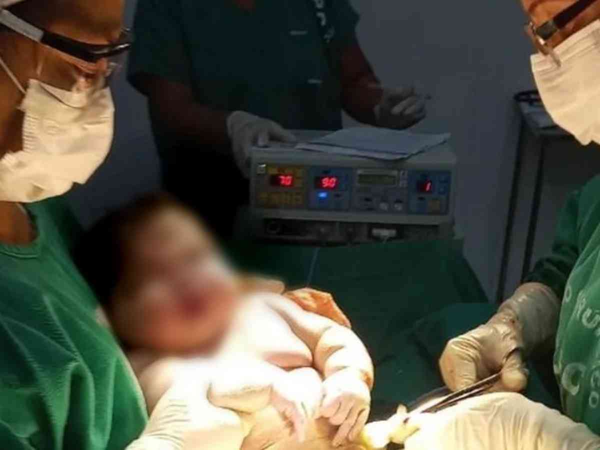 Bebê de 7,3kg no as: quais os riscos de dar à luz um filho 'gigante'  - Saúde - Estado de Minas