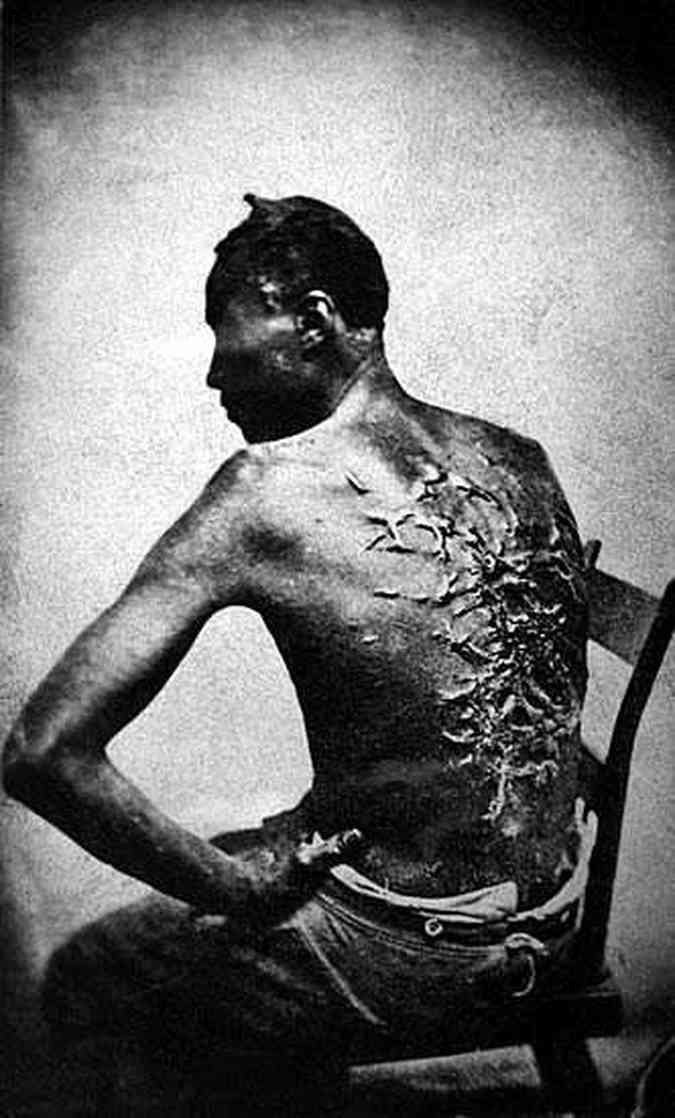 Marcas de castigos aos escravos da cultura de algodo: o horror nas fazendas no sul dos Estados Unidos.(foto: McPherson and Oliver - U.S. National Archives, 1863)