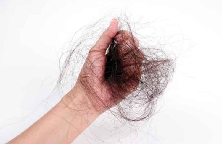 A queda de cabelo pode ser um problema difcil de lidar, mas existem opes de tratamento que ajudam a prevenir a calvcie e a recuperar a sade dos fios