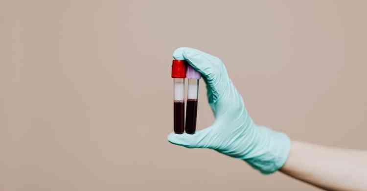 Dois tubos de ensaio contendo sangue 