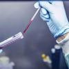 Parkinson: exame de sangue poderá diagnosticar a doença precocemente