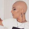 Cabeleireira mineira com alopecia fica careca: 'Perdi os fios e clientes'