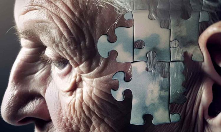 Alzheimer 