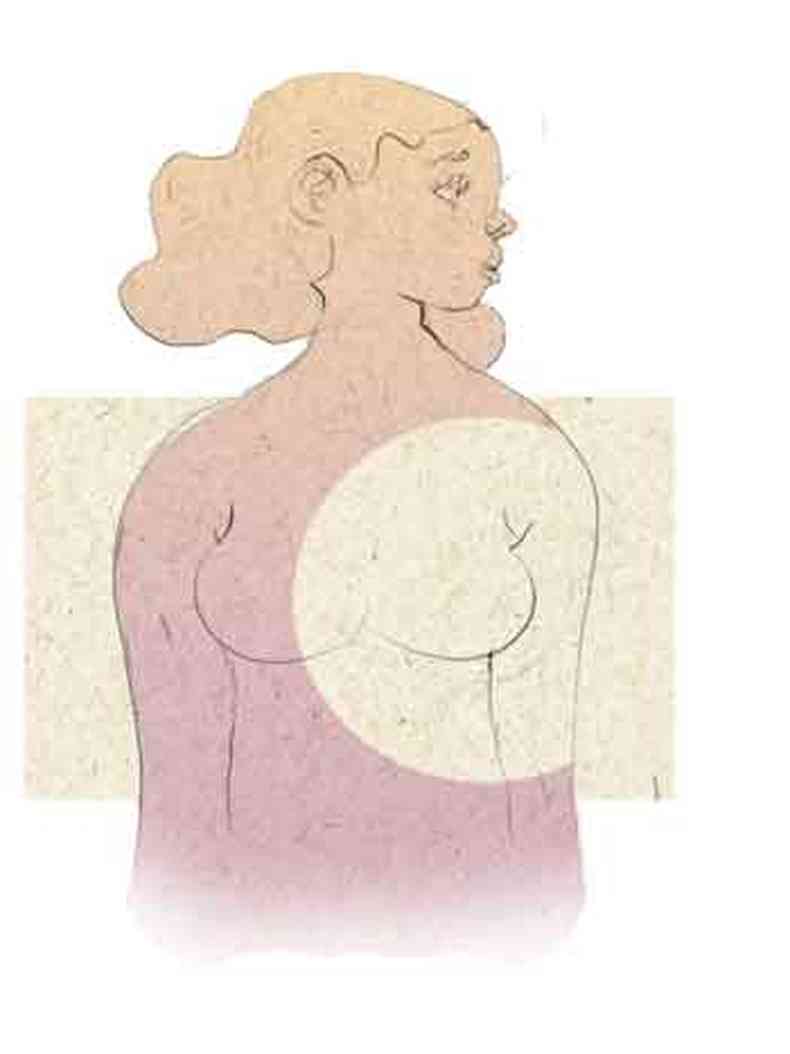 Ilustrao do Lelis sobre cncer de mama