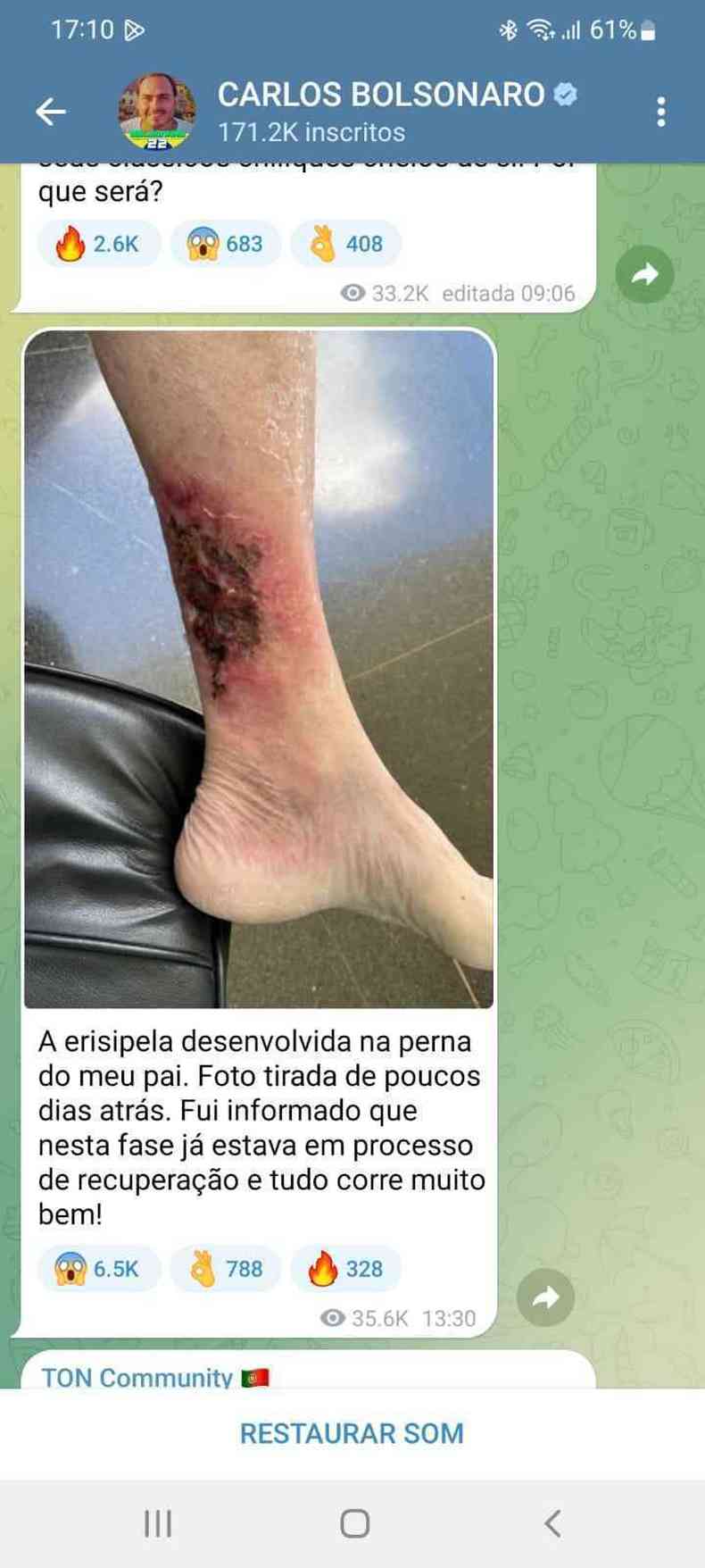 Carlos Bolsonaro utilizou Telegram para divulgar ferimento de Jair Bolsonaro