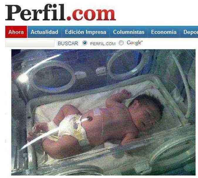 Garoto nasceu com o tamanho de uma criana de 5 ou 6 meses(foto: Reproduo Internet / www.Perfil.com)