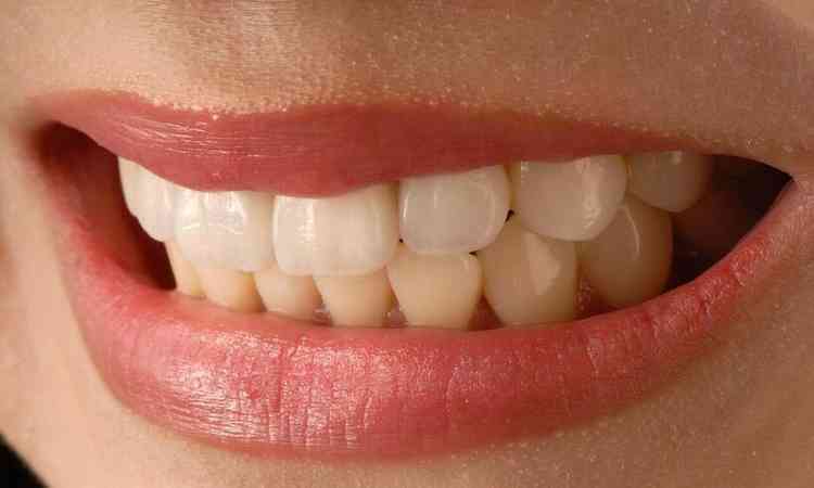 sorriso de uma mulher com batom vermelho, aparecendo apenas os dentes