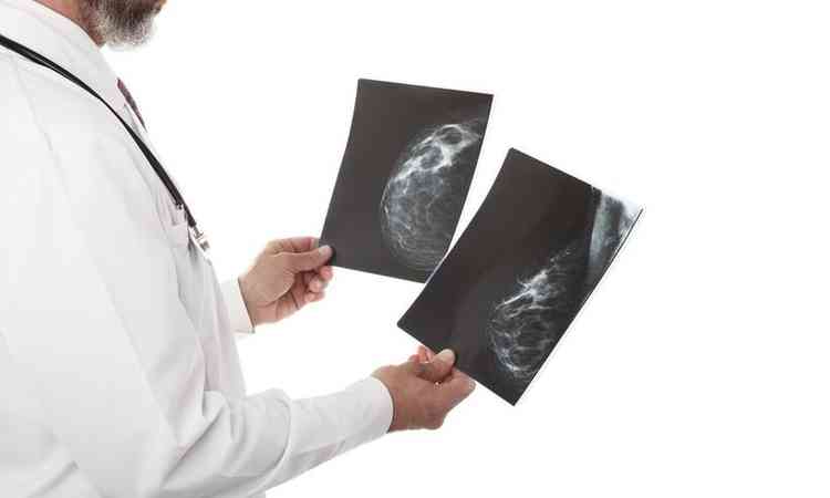 imagens de mamografia