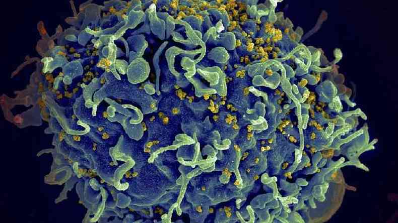 Eletromicrografia mostra HIV infectando clula humana