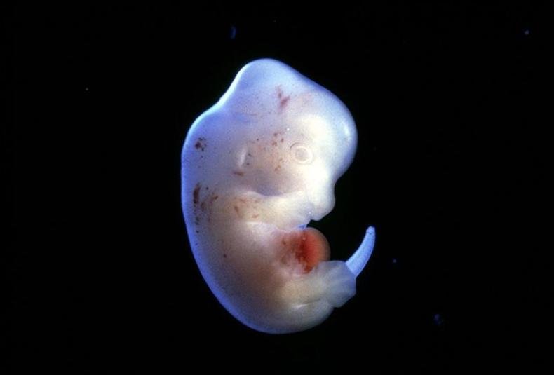 (foto: Science Pictures ltd/SPL) (foto: Science Pictures ltd/SPL)