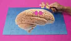 Covid longa: estudo identifica efeitos na funo cerebral at 2 anos aps infeco