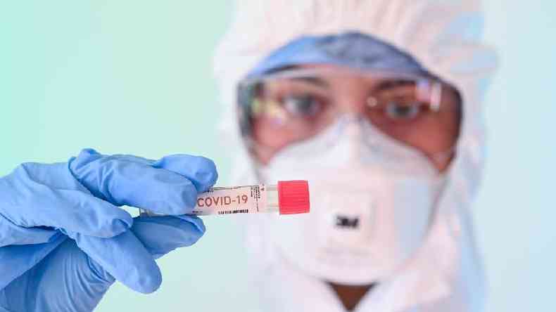 A enzima da bactria de Yellowstone revolucionou a tcnica PCR, usada na atual pandemia do novo coronavrus