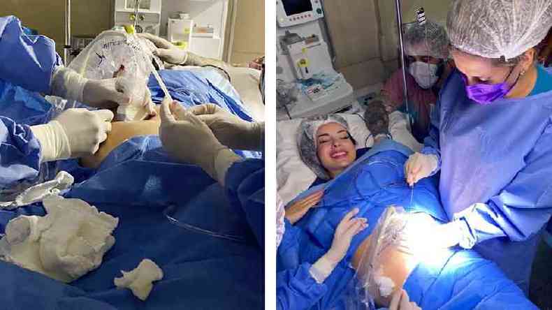 À esquerda, médica recebe a agulha enquanto ultrassom é feito para localizar o tumor; à direita, Polyana, medicada, recebe a incisão da agulha capaz de queimar o tumor