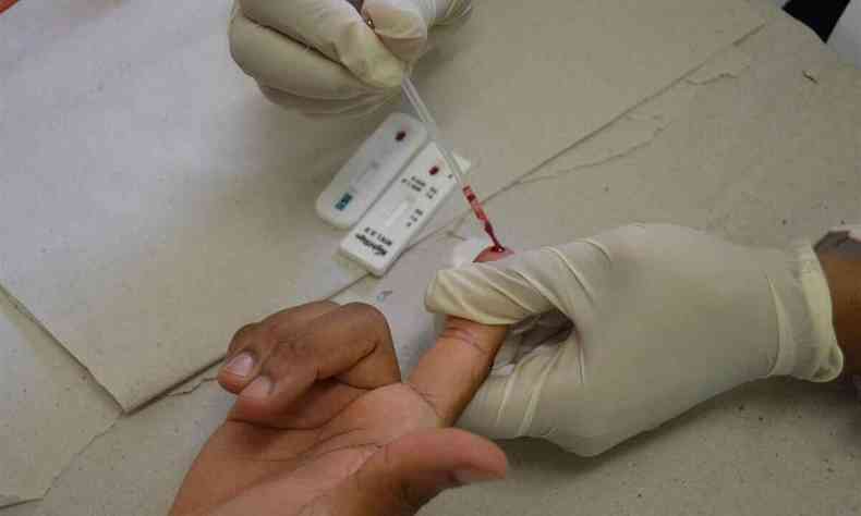 Teste diagnstico de HIV/Aids