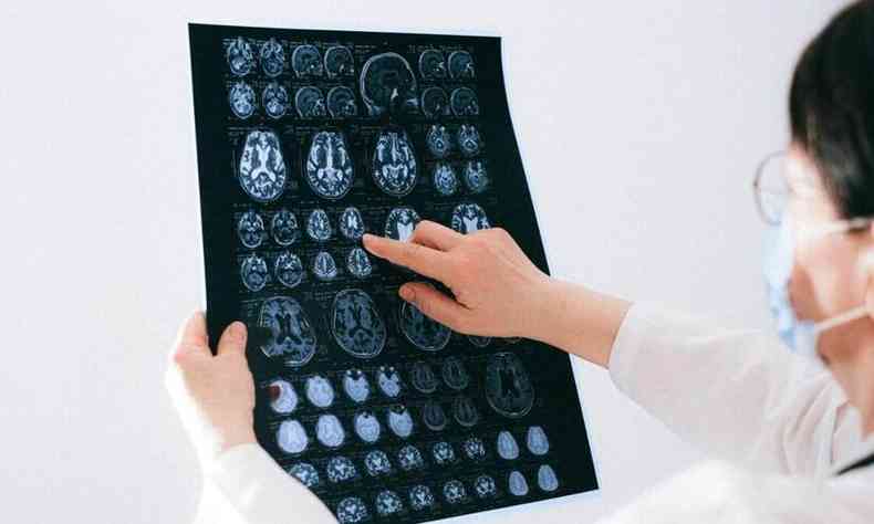 Radiografia do crebro