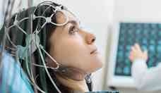 Estimulao cerebral turbina memria por um ms, diz estudo