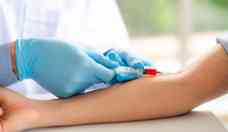 Exames de sangue nem sempre exigem jejum: saiba quando  recomendado