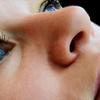Rinoplastia sem martelo: saiba mais sobre o método francês