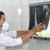 Dia Mundial de Combate à Tuberculose: Brasil registra 78 mil novos casos