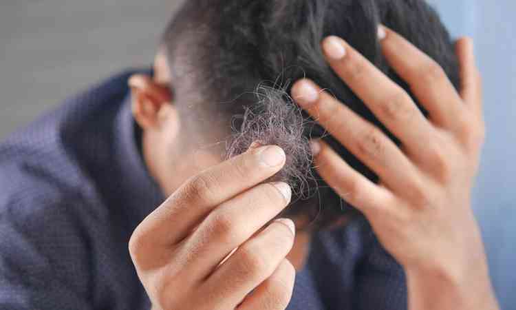 homem mostra tocha de fios de cabelo depois de pentear o cabelo