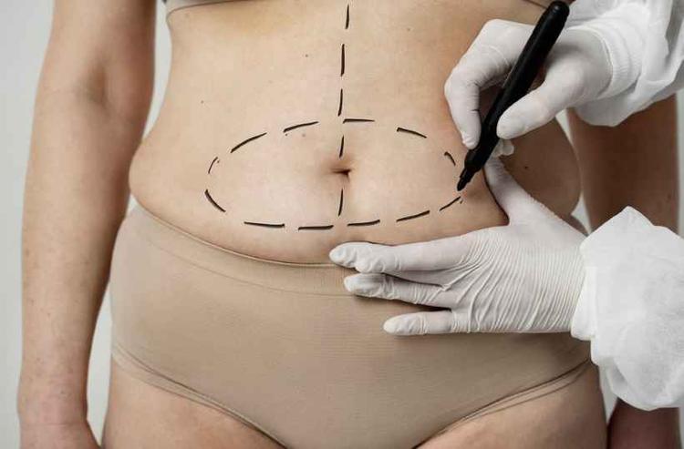 Mulher sendo avaliada para realizao de cirurgia plstica