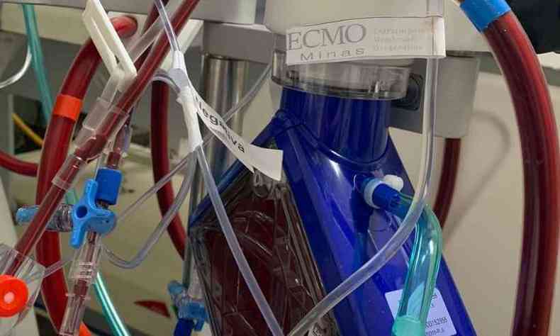 A ECMO pode servir como suporte cardaco, respiratrio ou cardiorrespiratrio.