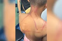 Casal � preso por suspeita de torturar crian�a