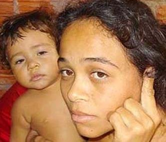 (foto: Patr�cia ficou com proj�teis alojados na cabe�a)